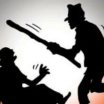बोक्सीको आरोपमा कुटपिटमा परेकी जैतुन अस्पताल भर्ना