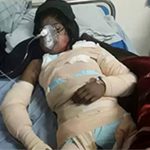 ‘२० वर्षीया युवतीलाई परिवारले जिउँदै आगो लगाए’